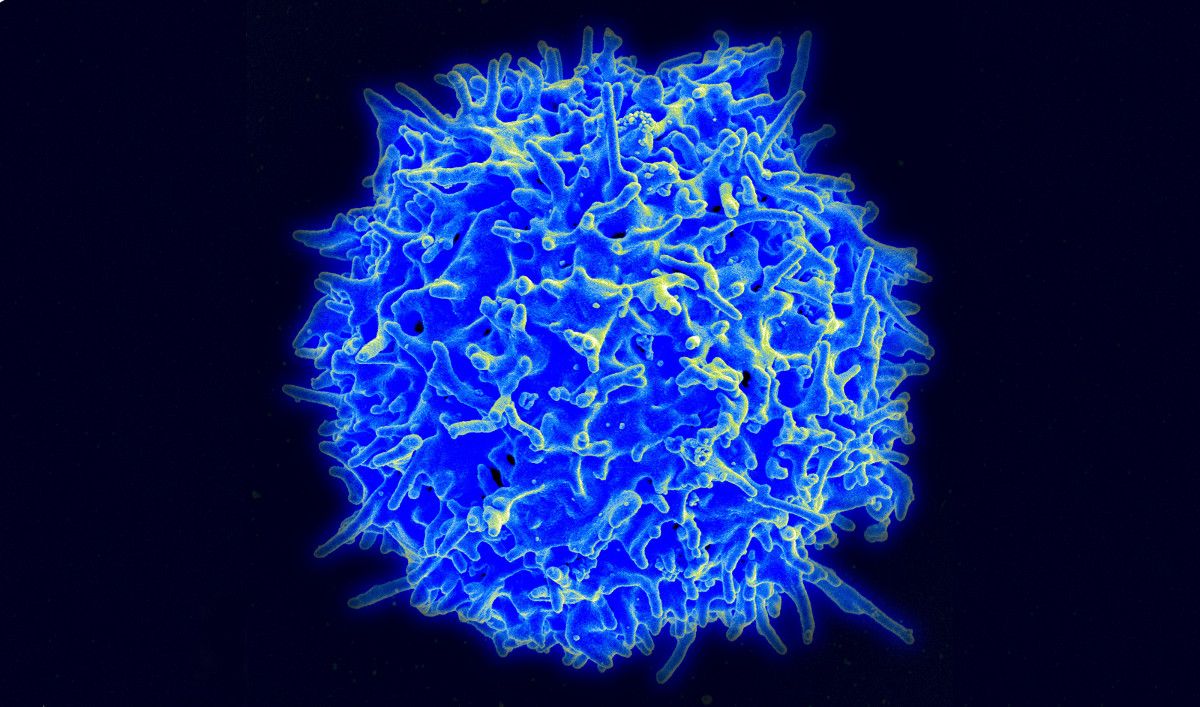 Descubren cómo un tipo de linfocito ‘recluta’ al sistema inmunitario para luchar contra uno de los cánceres de mama más agresivos