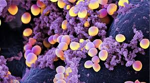 Prevalencia y factores de riesgo de infección por Staphylococcus aureus resistente a meticilina en niños