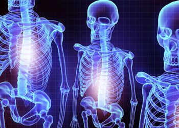 Expertos recomiendan técnicas de refuerzo vertebral en fracturas osteoporóticas para recuperar la movilidad