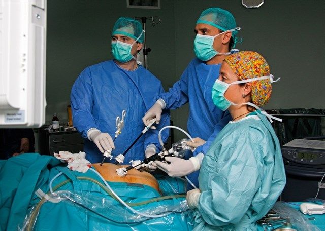 Un nuevo dispositivo disector que separa y limpia las estructuras anatómicas durante la cirugía laparoscópica