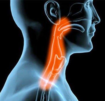 Un raro caso de metástasis parafaríngea y de conducto auditivo por carcinoma papilar de tiroides