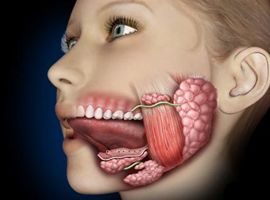 Sialoendoscopia: el fin de la adenectomía abierta en enfermedad salivar benigna