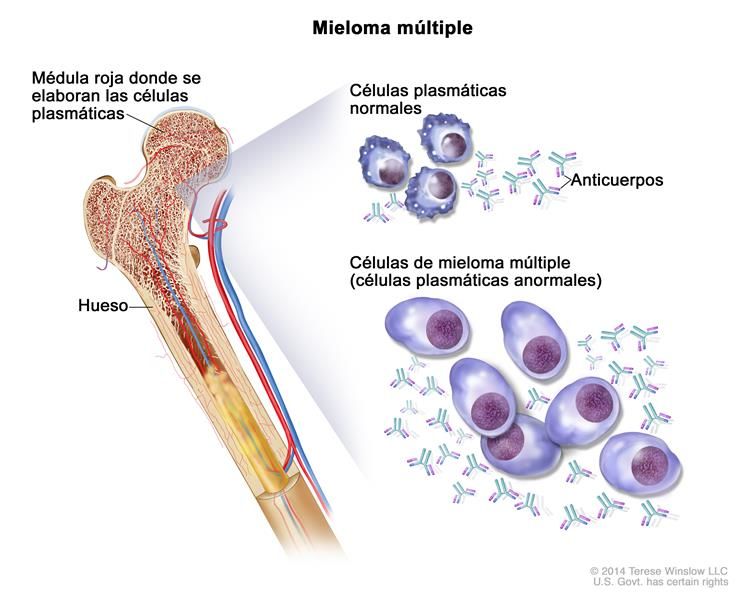 Una nueva inmunoterapia contra el mieloma múltiple muestra en el laboratorio más efectividad que la CAR-T ya en uso
