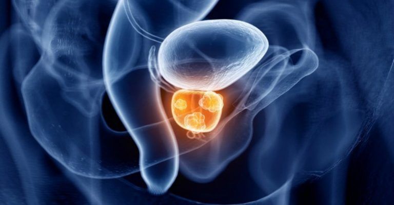 Se recibe opinión positiva del CHMP para Enzalutamida en un escenario adicional de tratamiento temprano recurrente del cáncer de próstata