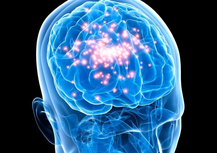 Epilepsia: entender cómo se manifiesta para tratarla correctamente