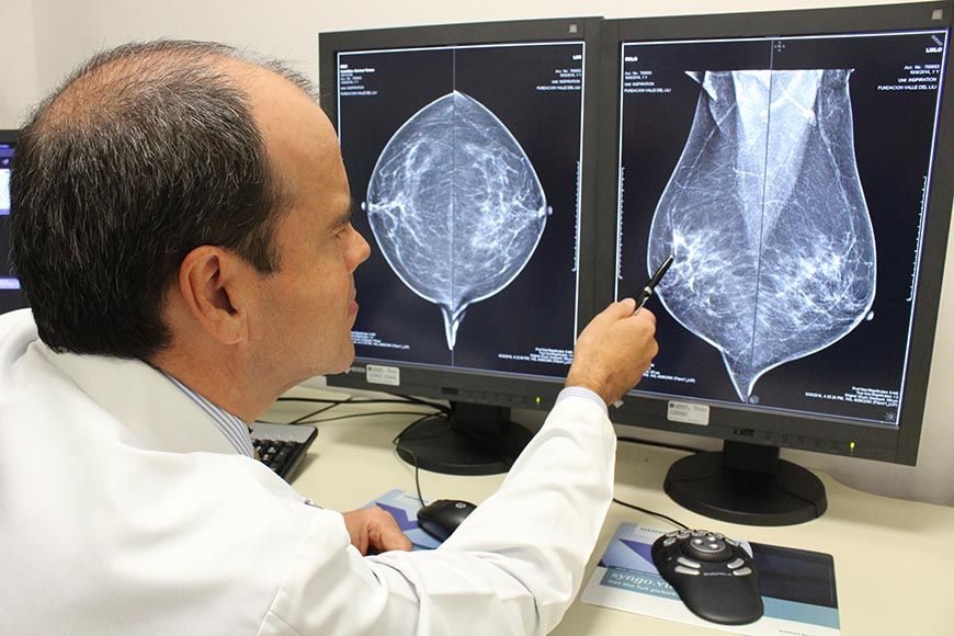 La mamografía por emisión de positrones en dosis bajas ayuda a identificar el cáncer de mama