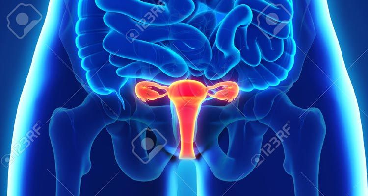 Necrosis uterina tras sutura de compresión hemostática: reporte de caso y revisión de la literatura