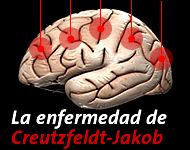 Presentación atípica en resonancia de cerebro de la enfermedad de Creutzfeldt-Jakob: reporte de un caso