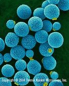 Recomendaciones para el diagnóstico y tratamiento de la infección por Cryptococcus spp.