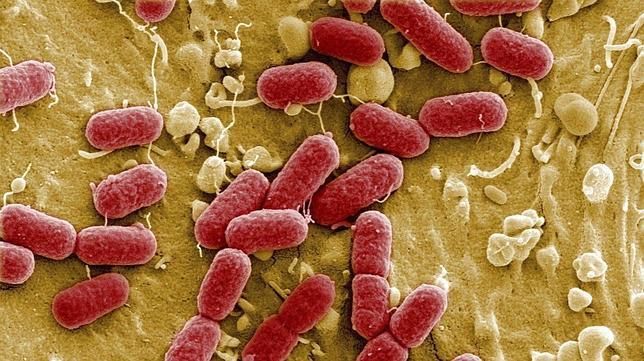 Escherichia coli productora de nueva Delhi metalo-β-lactamasa en Colombia: reporte de caso