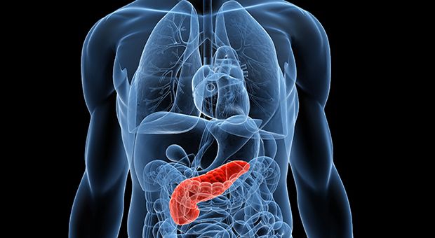 SIRS como predictor de severidad en la pancreatitis aguda