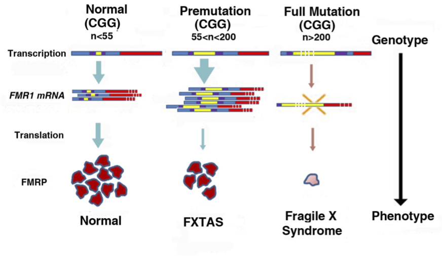 Síndrome de Tremor Ataxia y Falla Ovárica Prematura en portadora de la premutación del gen FMR1