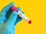 La infección con el Zika después de nacer podría requerir de un seguimiento a largo plazo
