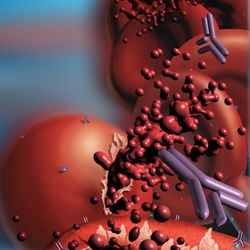 Caracterización de la anemia hemolítica autoinmune y utilidad de la prueba de antiglobulina directa monoespecífica en el diagnóstico