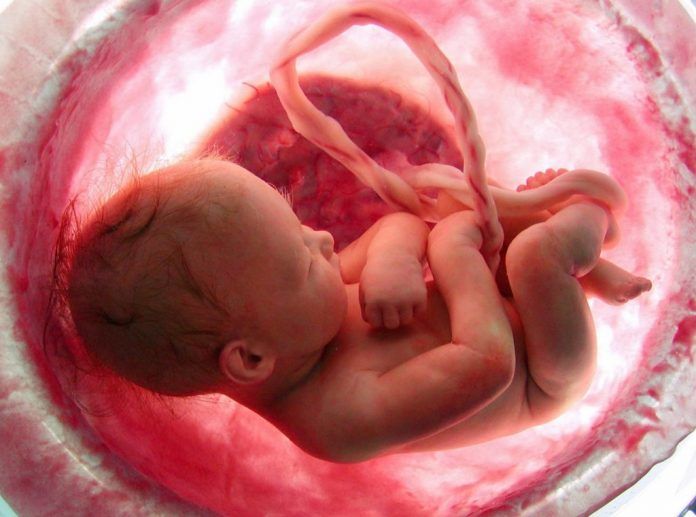 Resultado a largo plazo de una serie de fetos con agenesia aislada del septum pellucidum