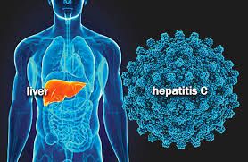 “Tenemos una oportunidad única de eliminar la hepatitis C que no podemos dejar pasar”