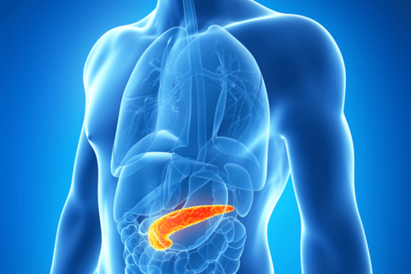 Nueva opción de primera línea para el cáncer de conducto pancreático metastásico