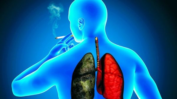 Tabaquismo y cáncer de pulmón. Cincuenta años de evidencia