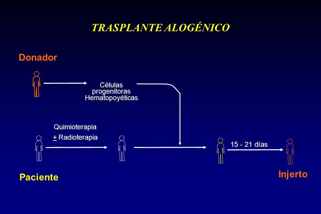 Papel del trasplante de células progenitoras hematopoyéticas en la leucemia mieloide aguda